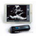 Handheld Veterinary use Ultrasound Scanner